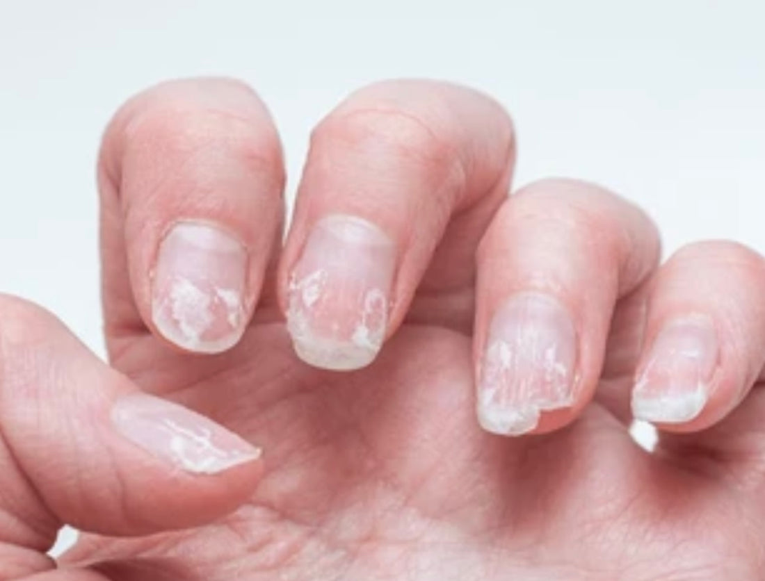 The Harm of Soak-Off Method to Nails